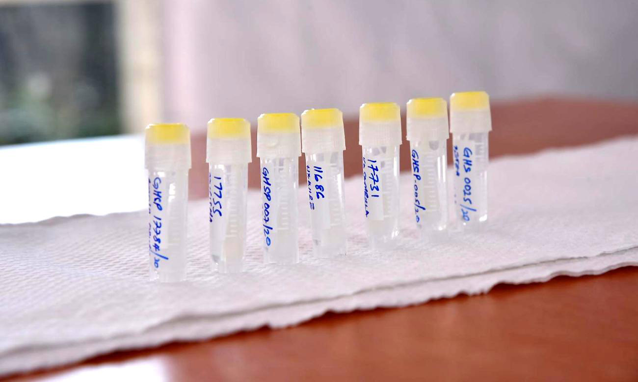 Samples collected from IDI staff who are at the frontline of the fight against COVID-19 on 2nd June 2020, IDI-MKC, Makerere University, Kampala Uganda.