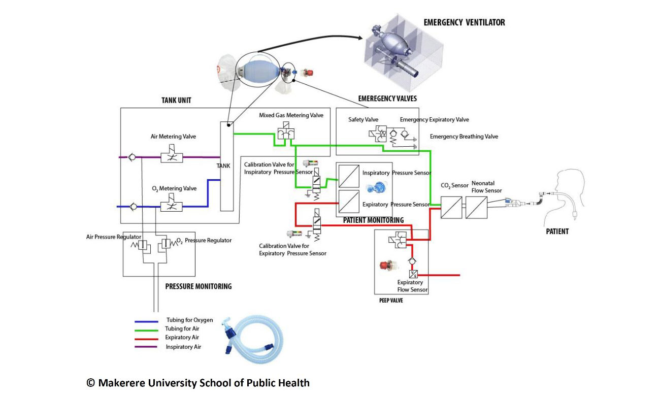 A schematic diagram of the Low-Cost Ventilator: A Collaborative Effort between Makerere University, ResilientAfrica Network (RAN)-a project of the School of Public Health, Kiira Motors Corporation and the Ministry of Science, Technology and Innovation