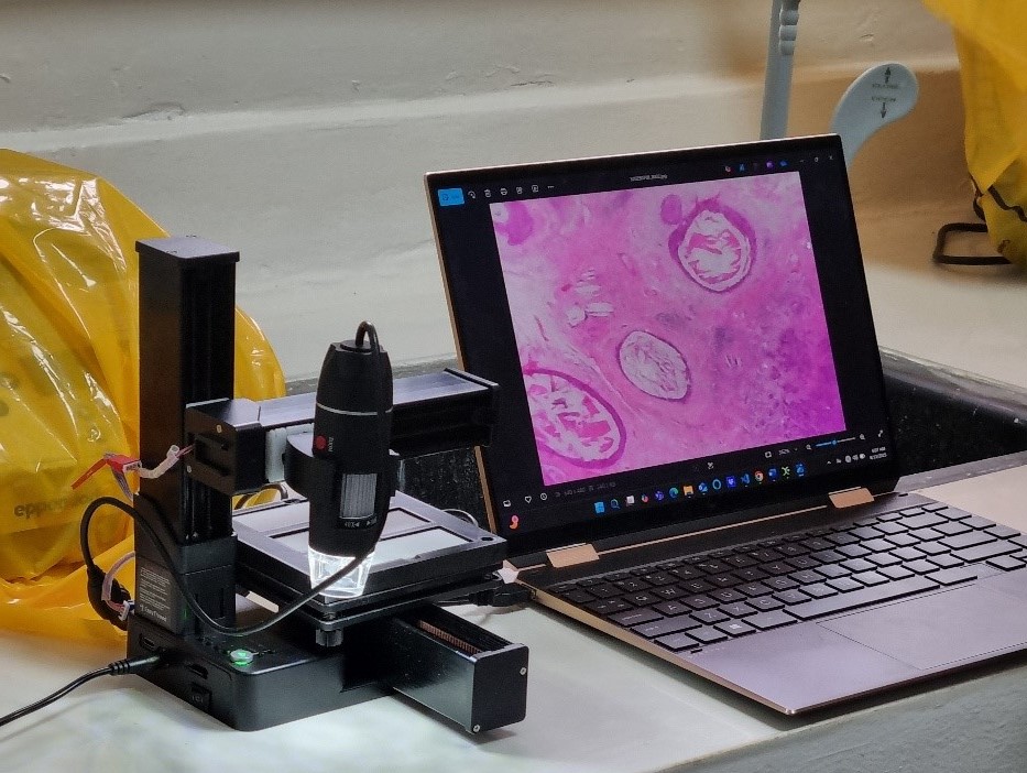 Ekyaalo Diagnostics hardware: A whole slide scanner and a Laptop displaying a scanned Image.